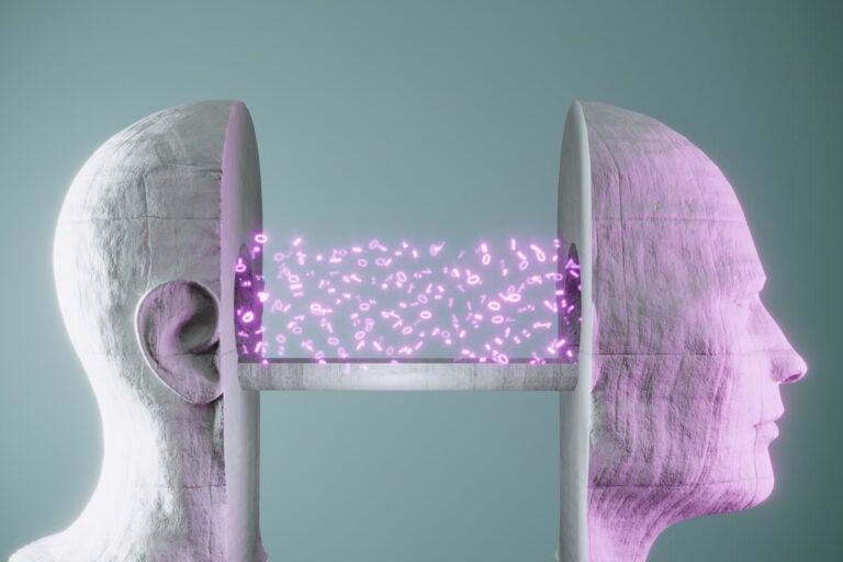 Augmented intelligence vs artificial intelligence